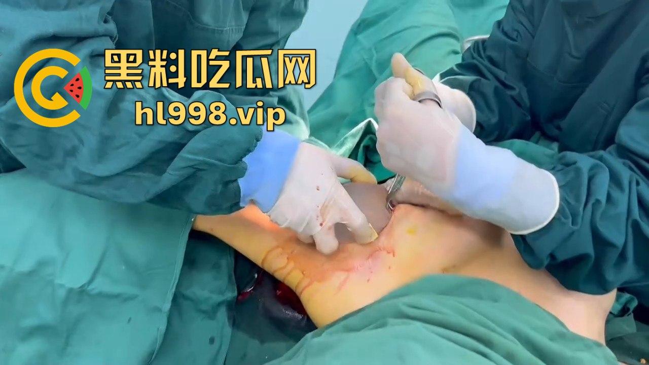 揭秘黄晓明女友『叶柯』同款隆胸术手术过程，看的让人心惊！胸被医生猛戳猛捣，视觉冲击强到不敢看！-7