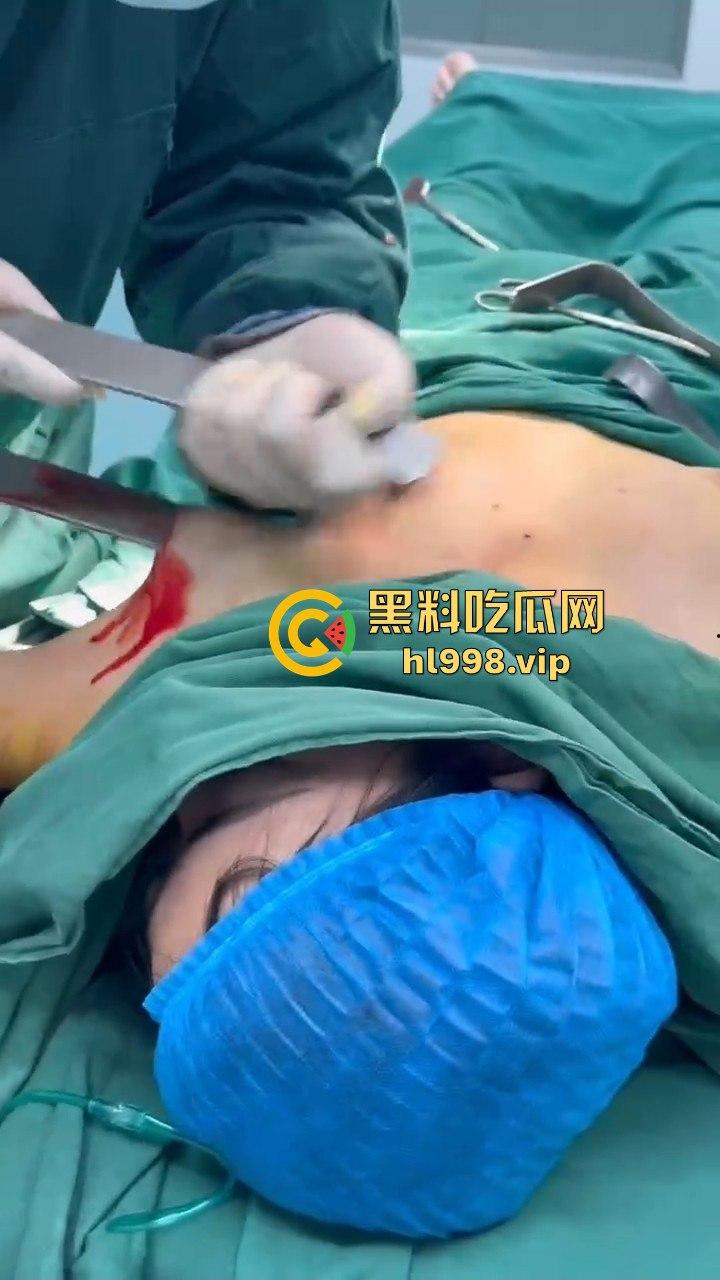 揭秘黄晓明女友『叶柯』同款隆胸术手术过程，看的让人心惊！胸被医生猛戳猛捣，视觉冲击强到不敢看！-10