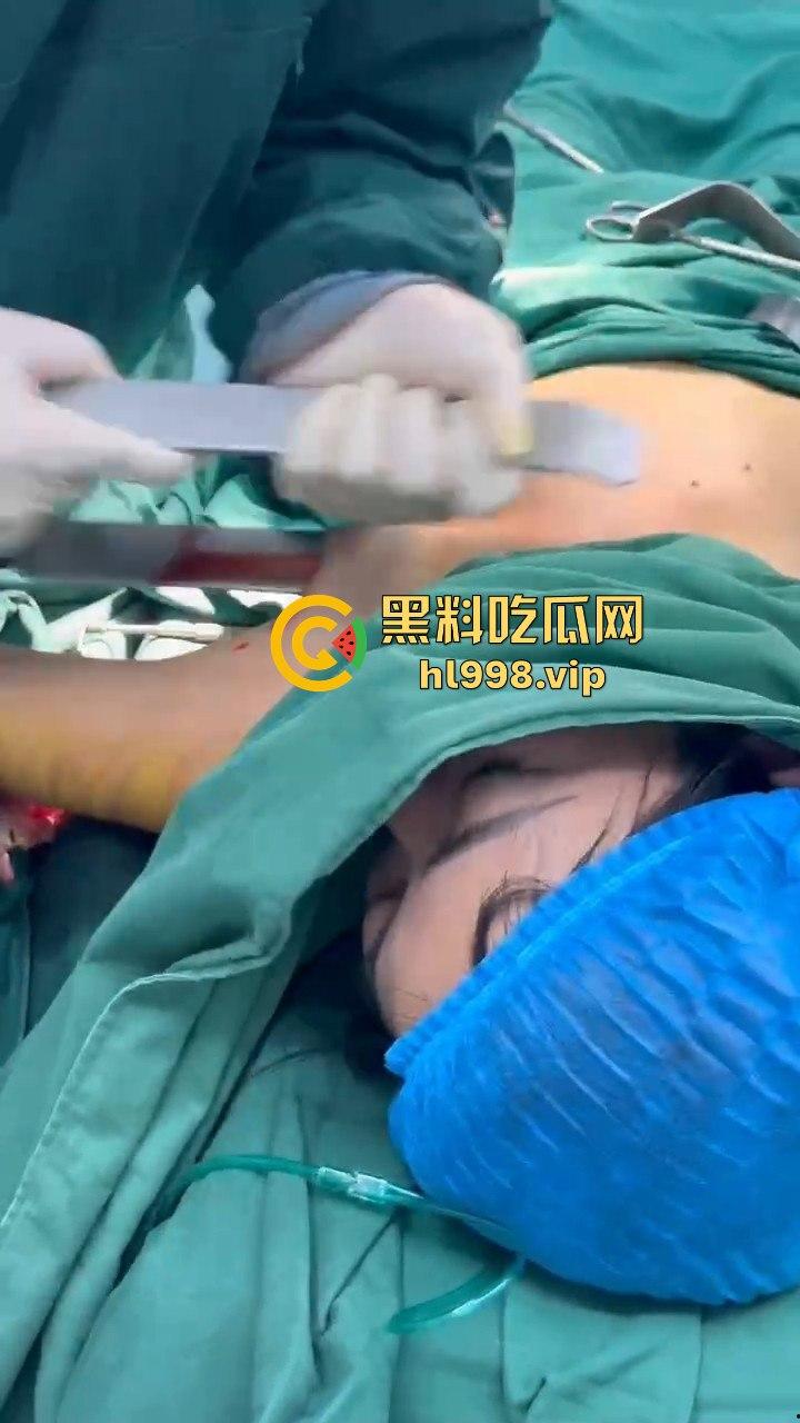 揭秘黄晓明女友『叶柯』同款隆胸术手术过程，看的让人心惊！胸被医生猛戳猛捣，视觉冲击强到不敢看！-14