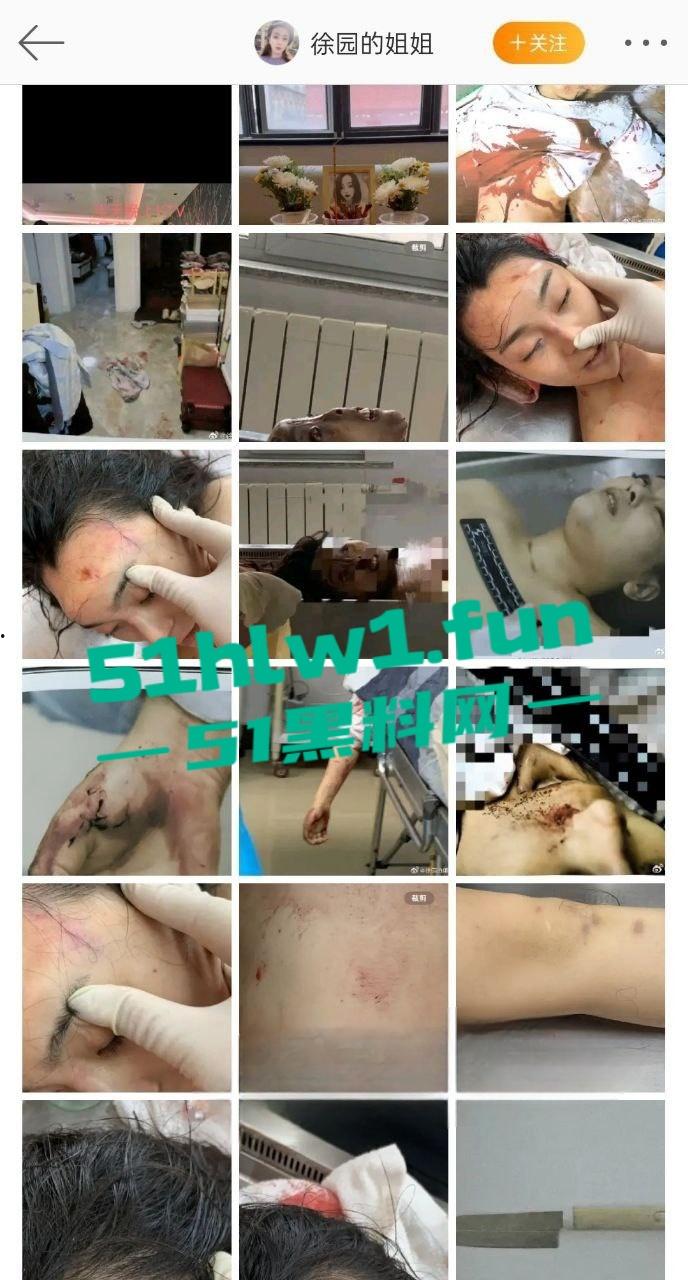 大连女孩【徐园】惨死男友家中，男友却被判无罪，案件再度发酵，尸检细节曝光震惊全网！-4
