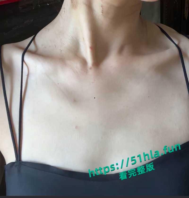 抖音女网红【轮滑冰姑娘】生化母体携带艾滋感染上千人人设翻车，遭网友质疑健康状况引发争议！-15