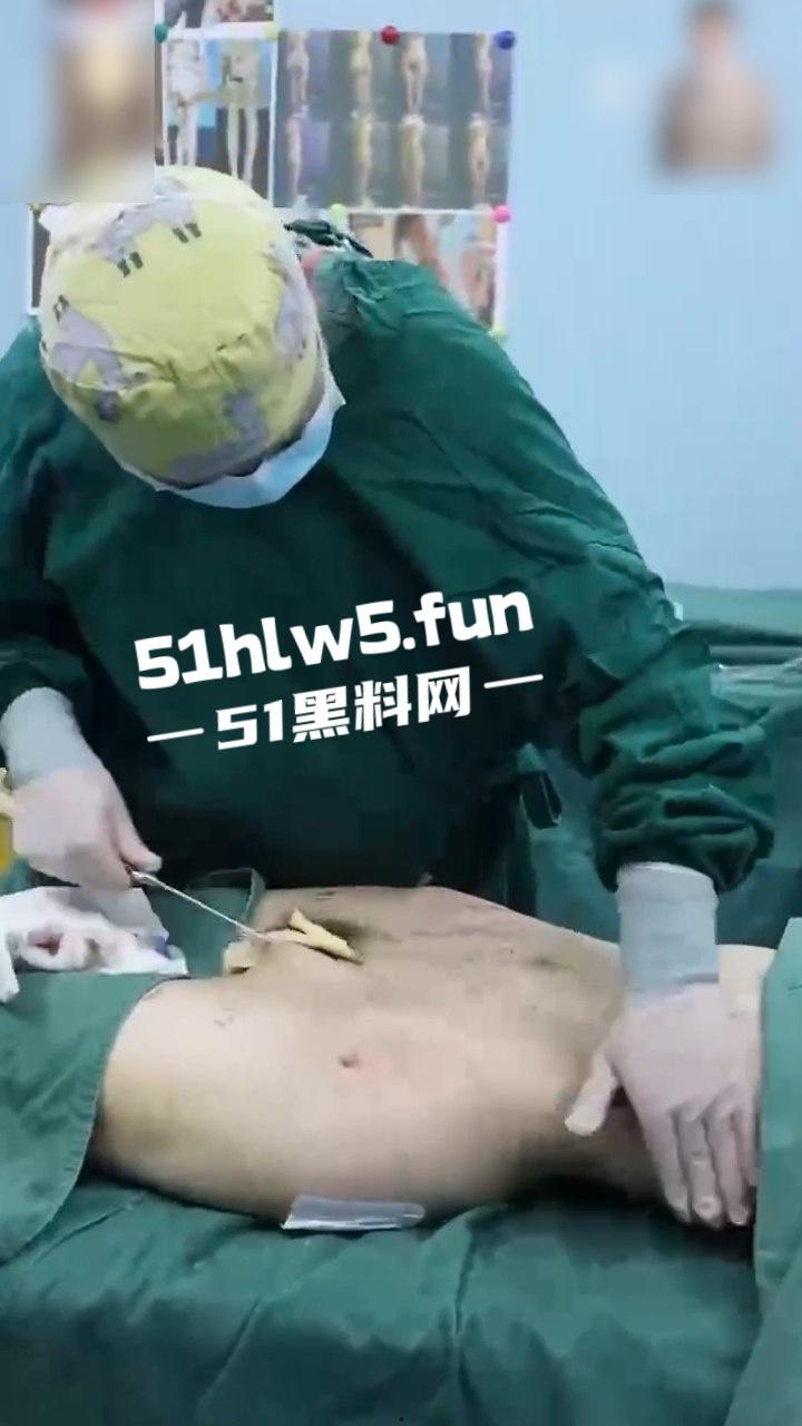 实拍整形医院，小仙女整容抽脂和填充全过程，看着残忍但做完后惊艳的效果让人震撼。-2